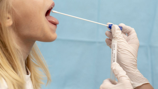 Covid Tongue